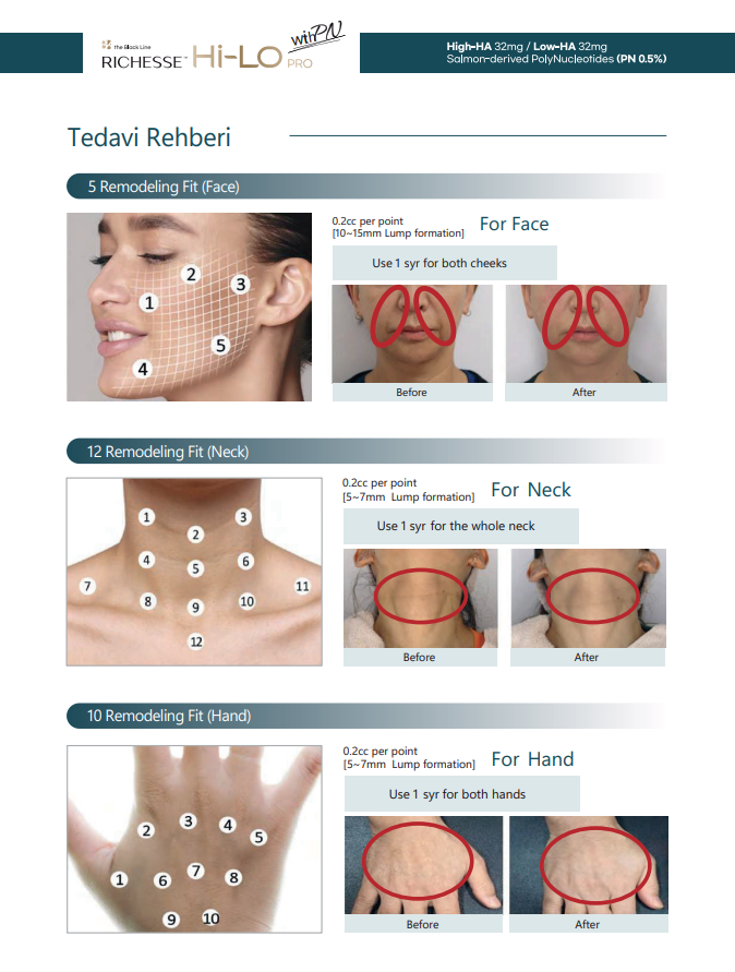 RICHESSE Hi-LO PRO detay